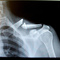 Collarbone_small_square
