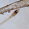 Litostomatea35.hi.092604_small_square