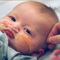 Bebe-enfermo_small_square
